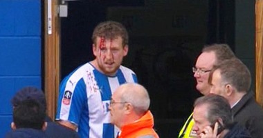إصابة دموية فى مباراة توتنهام وكولشيستر بكأس الاتحاد الإنجليزى
