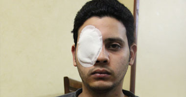 بالفيديو.."جودة" عامل بكافيه مجاور للاتحادية يفقد عينه بطلق خرطوش.. المصاب: الأمن أطلق علينا النار أثناء تأدية عملنا متعمدا قتلنا.. ووالده: سنقاضى وزير الداخلية ورئيس الجمهورية لأنهما المسئولان 