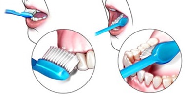 نصائح لحماية الأسنان من التسوس أهمها نضف لسانك وشفايفك