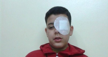 إصابة تلميذ فى طنطا بجرح بشبكية العين أثناء فض مشاجرة بين زميليه