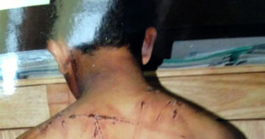 3 أشخاص يعذبون "عربجى" لإجباره على الاستمرار فى العمل بحلوان