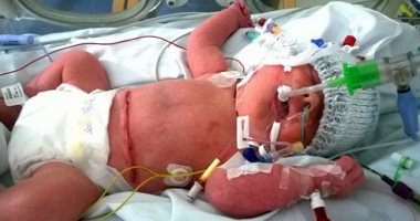 طفل 6 سنوات يضرب شقيقته الرضيعة حتى الموت فى فلوريدا
