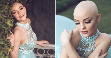 بالصور .. حكاية "أندريا سييرا" فتاة تحدث السرطان بـ"فوتو سيشن" بالفستان