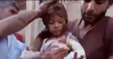 الإندبندنت: طفل سورى مصاب يعالج بالطين بسبب نقص الإمدادات الطبية بحمص