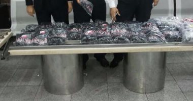 ضبط أدوات علاج أسنان بقيمة 150 ألف جنيه بحوزة راكب فى مطار القاهرة