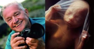 بالصور .. "لينارت نيلسون" مصور يقضى 10 سنوات من حياته يسجل لحظات نمو الجنين البشرى.. بداية من الحمل حتى الولادة.. ويستخدم منظار المثانة وكاميرا تسجل حياة الجنين فى رحم الأم