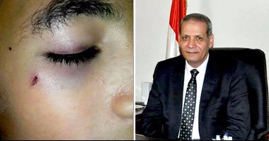وزير التعليم يحيل واقعتى إصابة تلميذين بالقاهرة والبحيرة للشئون القانونية