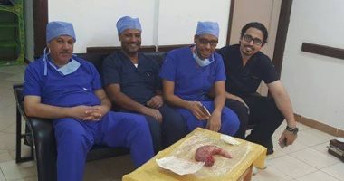 بالصور.. فريق طبى ينجح فى تدبيس معدة طفل وصل وزنه لـ170 كيلو بأسوان