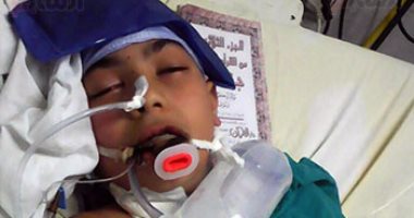 بسبب الإهمال..طفل يدخل مستشفى شبين الكوم بكسر ذراعه فيدخل فى غيبوبة 7 أيام