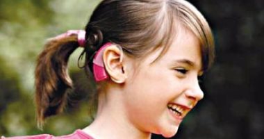 3 عناصر يشترط توفرها عند إجراء عملية زراعة قوقعة لمريض ضعف السمع  