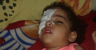 الطفلة "ريتال" مصابة بضمور بالمخ.. ووالدتها تناشد وزير الصحة لعلاجها
