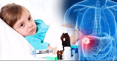 مرض ويلسون.. شائع بين الأطفال ويسبب تليف الكبد والتهاب المفاصل