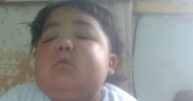 طفل مصاب بمرض نادر ووالدته تناشد وزير الصحة علاجه بالخارج