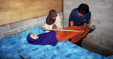 بالصور.. إندونيسية تعانى من مرض نادر يجعلها غير قادرة على الانحناء