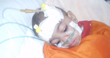 قارئ يطالب بعلاج طفلته المصابة بانسداد فى الشرايين وتحتاج لجراحة بالخارج