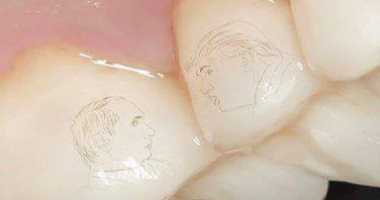 روسى يرسم صورة بوتين وترامب على أسنانه
