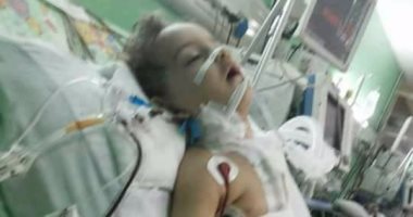 مأساة بسملة.. خطأ طبى يشوه صدر الطفلة والمستشفى ترفض استكمال علاجها