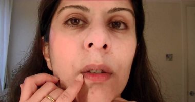 4 نصائح للتخلص من اسمرار الجلد حول الفم قللى التدخين ورطبى المنطقة اليوم السابع