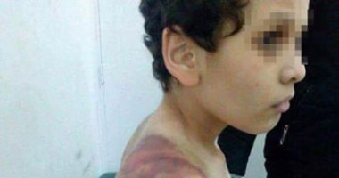 تأجيل محاكمة المتهمة بتعذيب طفل الشروق لجلسة 9 مارس