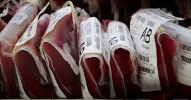 طب الإسكندرية: عدلنا أسعار أكياس الدم لمرضى العلاج بالأجر