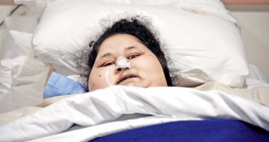 مستشفى برجيل الإماراتية: "أسمن امرأة بالعالم" تستغنى عن أنبوب المعدة قريبا