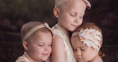 أصيبت شقيقتهما بالسرطان فحلقن شعرهن للتضامن معها.. تعرف على القصة