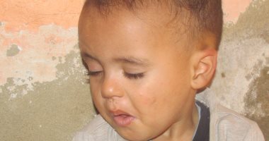 بالصور... مأساة طفل يحتاج لزراعة عدسة عين بديلة وأسرته لاتملك التكاليف