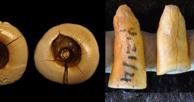 إيطاليا استخدمت البيتومين فى طب الأسنان القديم منذ 13 ألف سنة