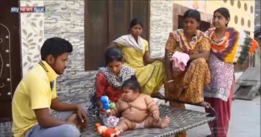 طفلة هندية تحير الأطباء.. عمرها 8 أشهر ووزنها يصل 17 كيلو