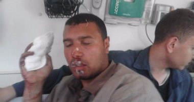 طالب ببنى سويف يعتدى على مدرس منعه من الغش ويصيبه بجرح قطعى فى الوجه