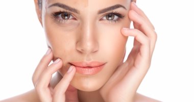 6 وصفات طبيعية لعلاج تصبغ الجلد وتوحيد لون البشرة