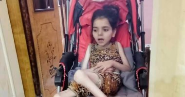 بالفيديو والصور.. الطفلة جنى تعانى من ضمور فى المخ ووالدتها تطالب بعلاجها