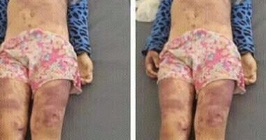 العثور على جثة طفلة مجهولة بها آثار تعذيب فى مرسى مطروح