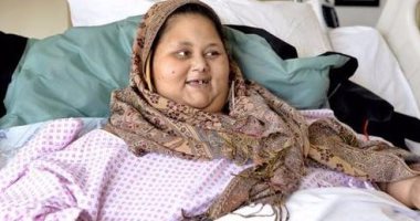  13 صورة ترصد رحلة أسمن امرأة فى العالم من مصر مرورا بالهند ومستشفى برجيل