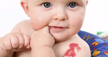 اعراض سرطان الدم عند الاطفال