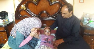 بالصور.. مأساة الطفل محمد مصاب بورم فى المخ.. ووالده يناشد بعلاجه خارج مصر