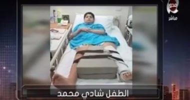 وزارة الصحة تتكفل بعلاج الطفل "شادى" ضحية ترام الإسكندرية
