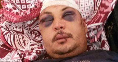 عامل بالشرقية يتهم مزارعًا بسحله وتعذيبه بسبب خلافات الجيرة