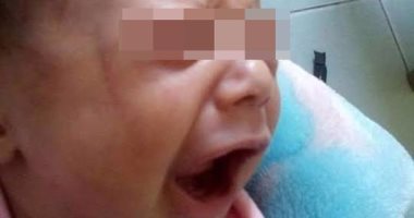 بالفيديو.. نقل رضيع ضحية تعذيب والدة للعناية المركزة لإصابته بنزيف بدمياط