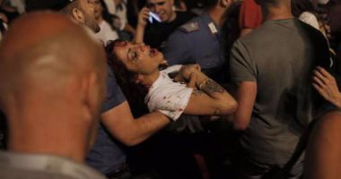 بالصور.. إصابة 465 شخصاً فى اشتباكات استفتاء كتالونيا بينهم طلق نارى فى العين