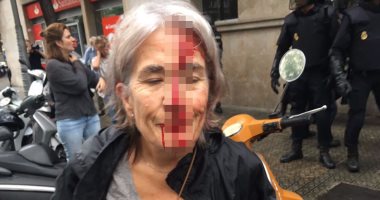 بالصور.. إصابة مسنيين مشاركين فى استفتاء كتالونيا 