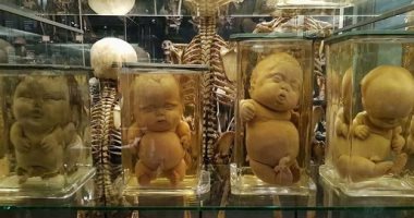 بالصور.. هولندا تحتفظ بجثث الأطفال المشوهة فى أنابيب زجاجية