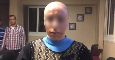 زوج يفقد حياته بالإسكندرية بسبب حلق شعر زوجته