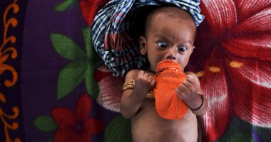 صور.. سوء التغذية يهدد حياة أطفال الروهينجا فى مخيمات بنجلاديش