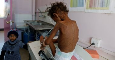 المنسق الأممى للشؤون الإنسانية يحذر من ارتفاع خطر المجاعة فى اليمن