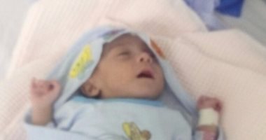 صور.. 50 ألف جنيه تنقذ قلب طفل حديث الولادة بالإسكندرية