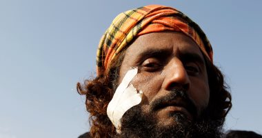 ننشر صور إصابات حركة لبيك الإسلامية بعد اشتباكات الشرطة الباكستانية