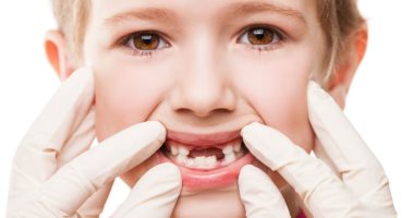 4 home ways to protect your child's teeth from decay during the Corona virus pandemic