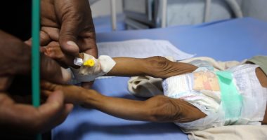 صور.. المجاعة وسوء التغذية يهددان حياة أطفال اليمن