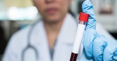 بريطانيا تطالب بتخفيض أسعار علاجات فيروس C للقضاء على المرض بحلول 2025